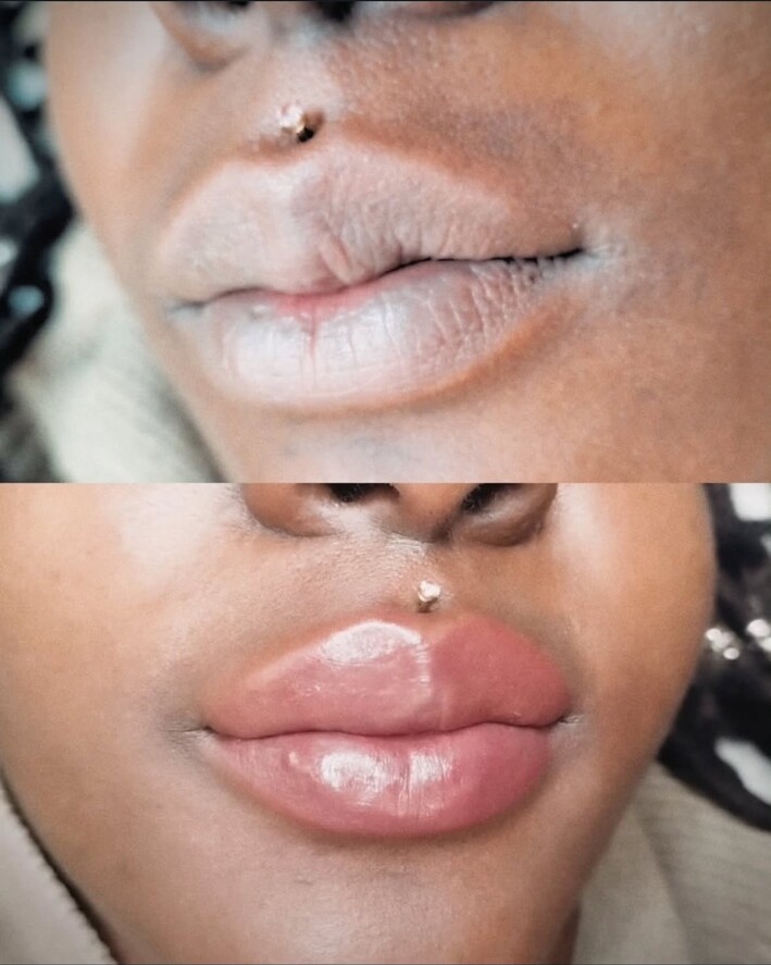 Teinte unifiée — pigmentation des lèvres par Le Pouvoir De Soi